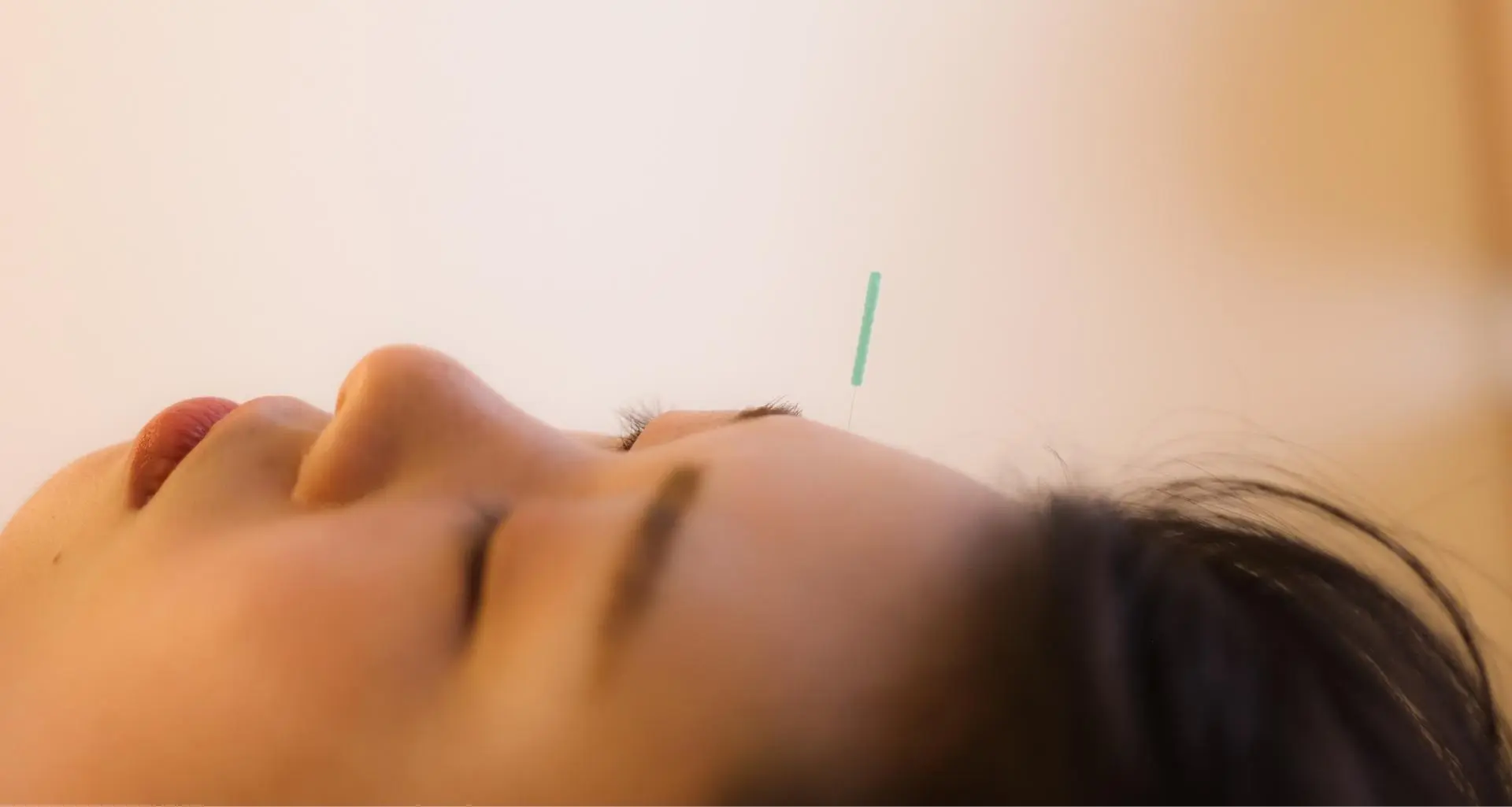 acupuncture suggestion points