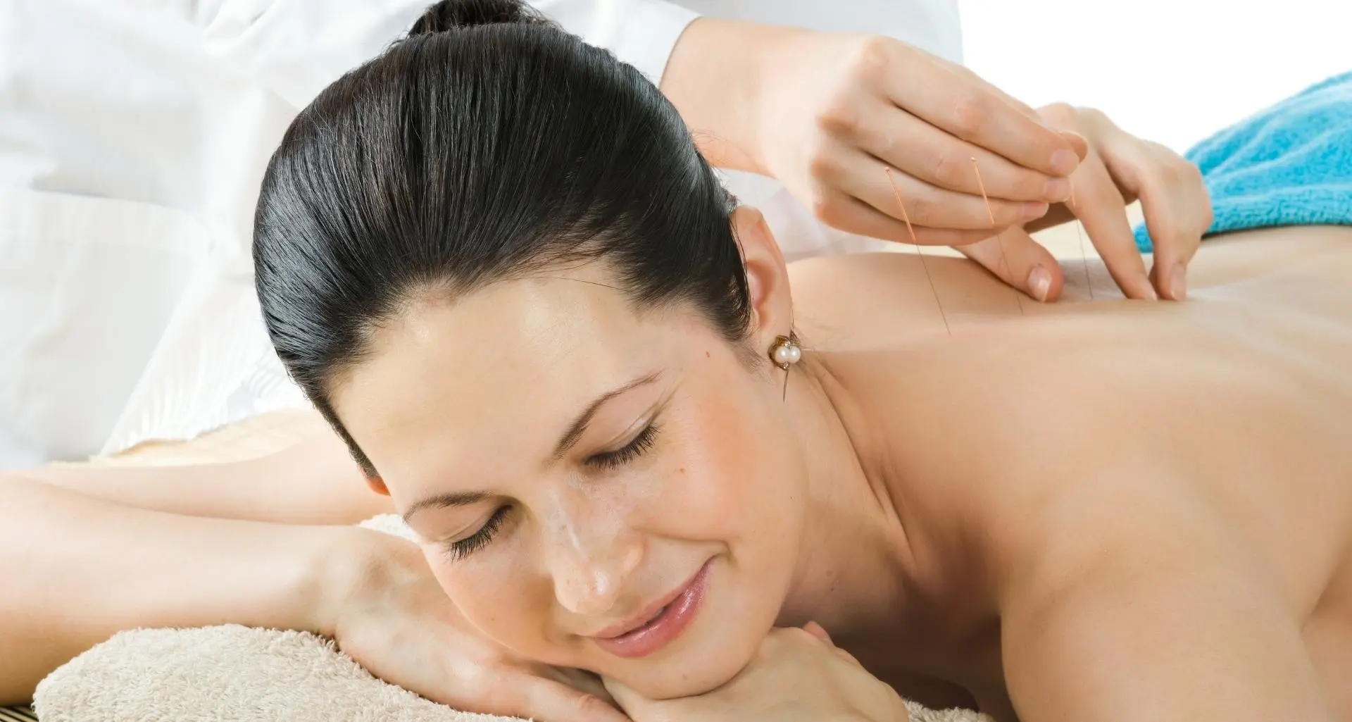 acupuncture suggestion points